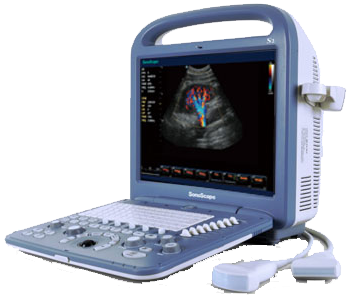 UNIVERSAL S2 PORTABLE VETERINARY ULTRASOUND SYSTEM