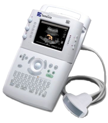 SONOSITE 180 ULTRASOUND