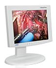 NDS ENDOVUE BCX15A1417 MONITOR 